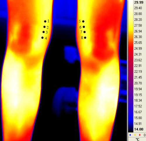 左右膝蓋的紅外熱成像
